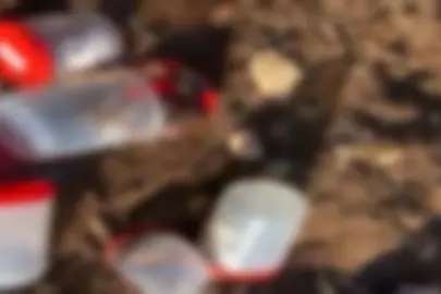 Şanlıurfa’daki Cenin Skandalında Flaş Gelişme!